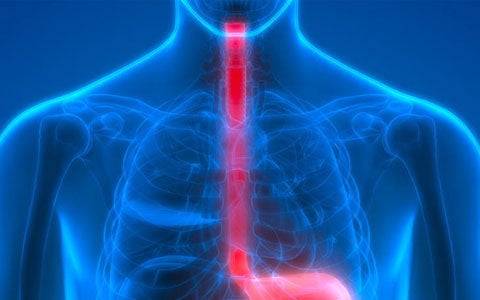 La disfagia esofagea: inquadramento clinico-diagnostico