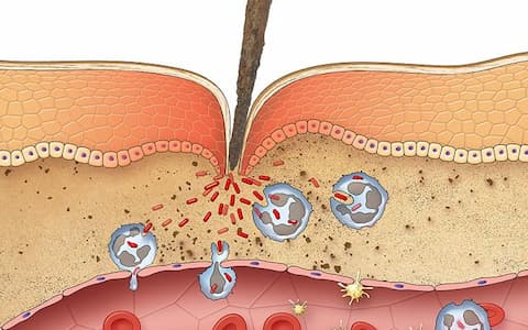 L’immuno-modulazione della terapia enzimatica nei processi di origine infiammatoria