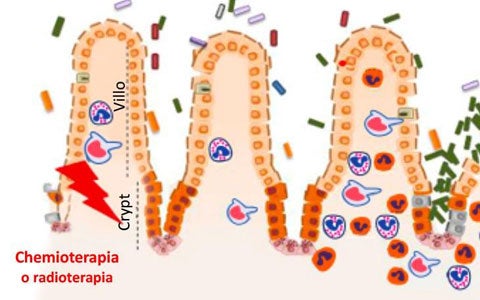 Le mucositi da radioterapia: insorgenza, prevenzione e gestione