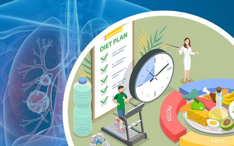 Neoplasie polmonari: quale gestione nutrizionale?