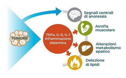 Cachessia e sarcopenia in oncologia: diagnosi e screening nutrizionali